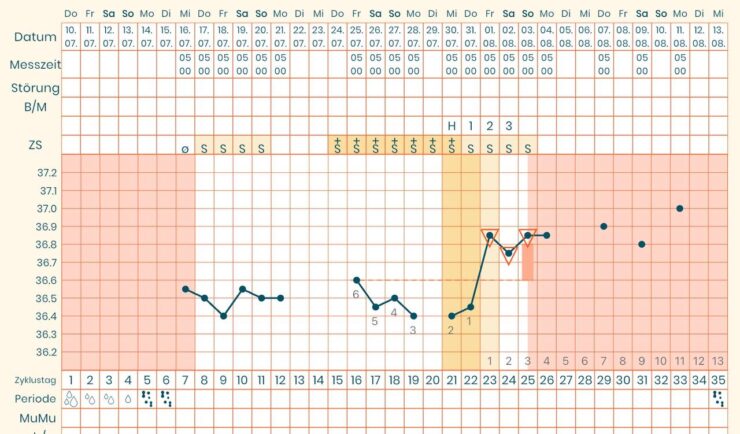 NFP-Zykluskurve Beispiel